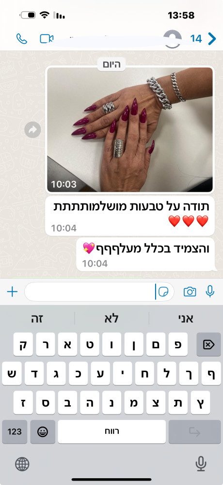 תודה על טבעות מושלמות וצמיד מעלף